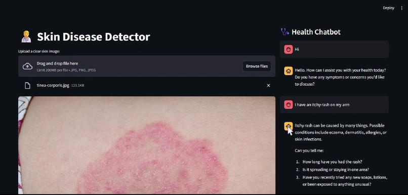 Skin Disease Detector & Health Chatbot – screenshot 1