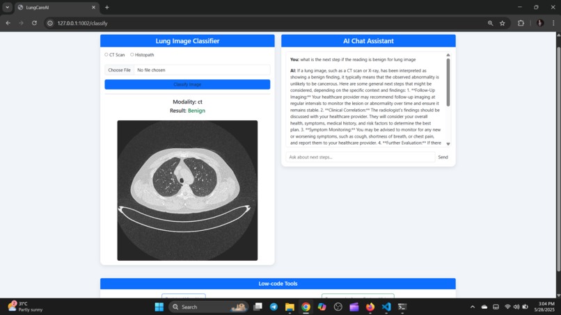 LungcareAI – screenshot 2