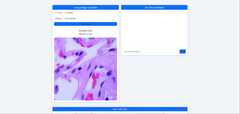 LungcareAI – screenshot 3