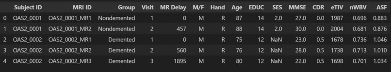 RecallX – screenshot 3