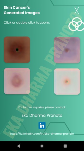 Synthetic Skin Cancer Image Generation Using GAN & 2D Deconv – screenshot 1