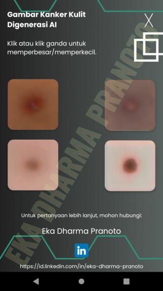 Synthetic Skin Cancer Image Generation Using GAN & 2D Deconv – screenshot 3