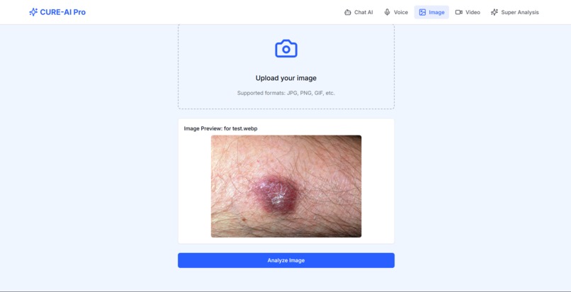 CURE-AI: Contextual Unified Response Engine for Healthcare – screenshot 9