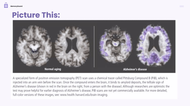MemoryGuard: AI-Powered Early Alzheimer's Detection – screenshot 2