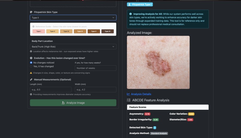 Skin Lesion Classifier – screenshot 1
