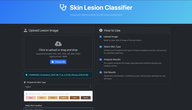 Skin Lesion Classifier – screenshot 3