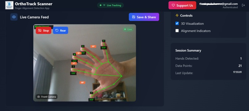 Ortho Alignment Tracker  – screenshot 4