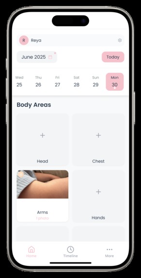 Allergee - a baby allergy symptom tracker app – screenshot 6