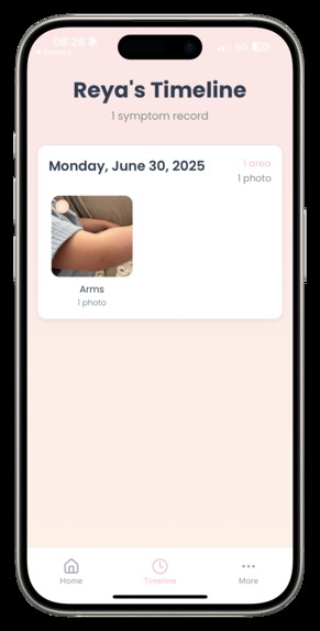 Allergee - a baby allergy symptom tracker app – screenshot 7