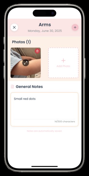 Allergee - a baby allergy symptom tracker app – screenshot 5