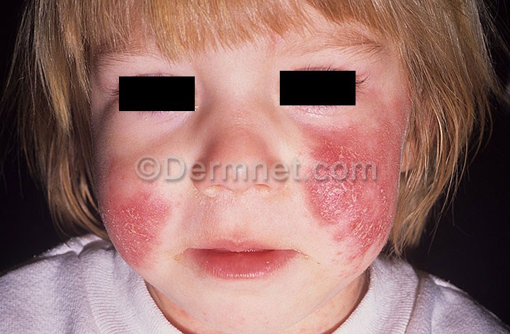 DermaSense – screenshot 1