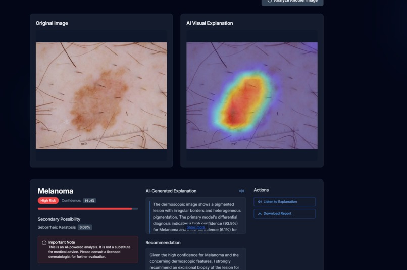 DermaSense – screenshot 3