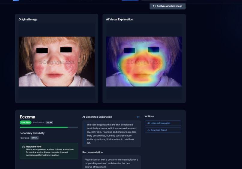 DermaSense – screenshot 4
