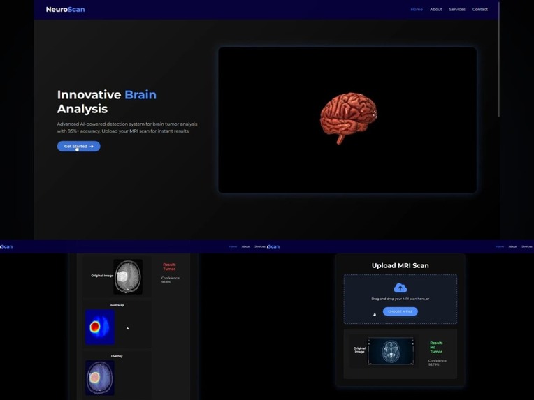 Brain-Tumor-Detection – screenshot 1