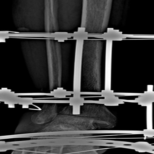OsteNet: A Novel Tool For Hairline Fractures In Bone Disease – screenshot 1