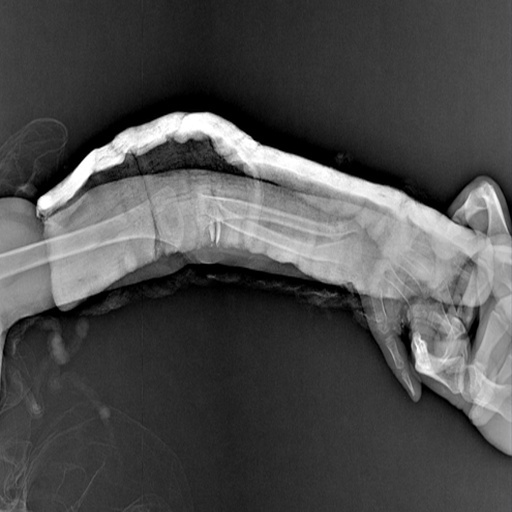 OsteNet: A Novel Tool For Hairline Fractures In Bone Disease – screenshot 4