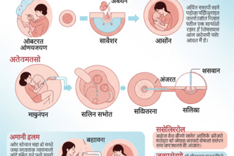 IVF Process and Treatment in Hindi