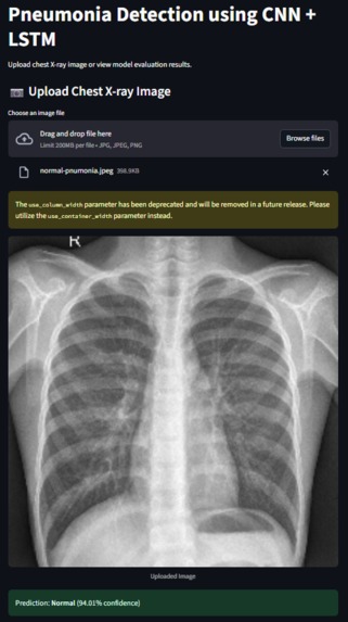 Pneumonia Disease Prediction – screenshot 1