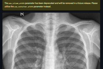 Pneumonia Disease Prediction