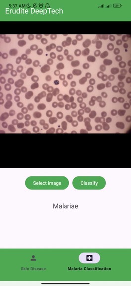 MedGrid: AI Diagnosis for Skin & Malaria on Android – screenshot 2