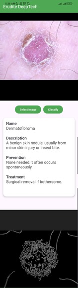 MedGrid: AI Diagnosis for Skin & Malaria on Android – screenshot 3