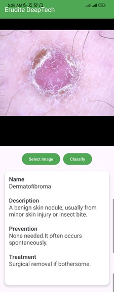 MedGrid: AI Diagnosis for Skin & Malaria on Android – screenshot 4
