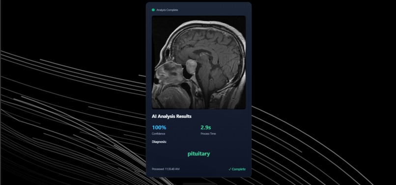 HealthAI – screenshot 1