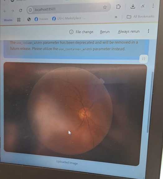 diabetic retinopathy – screenshot 1