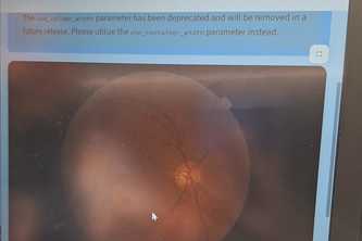 diabetic retinopathy