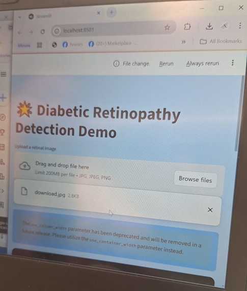diabetic retinopathy – screenshot 2