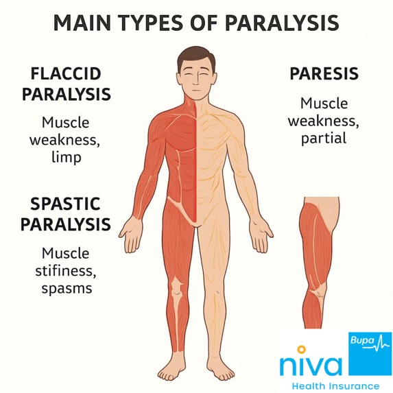 What are the Main Types of Paralysis – screenshot 1
