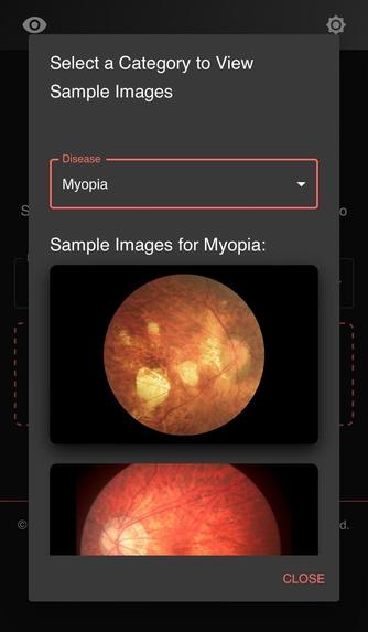 Ocular Disease Recognition – screenshot 2