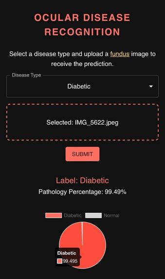 Ocular Disease Recognition – screenshot 3