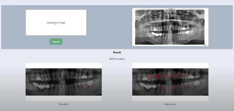 FurcaVision – screenshot 2