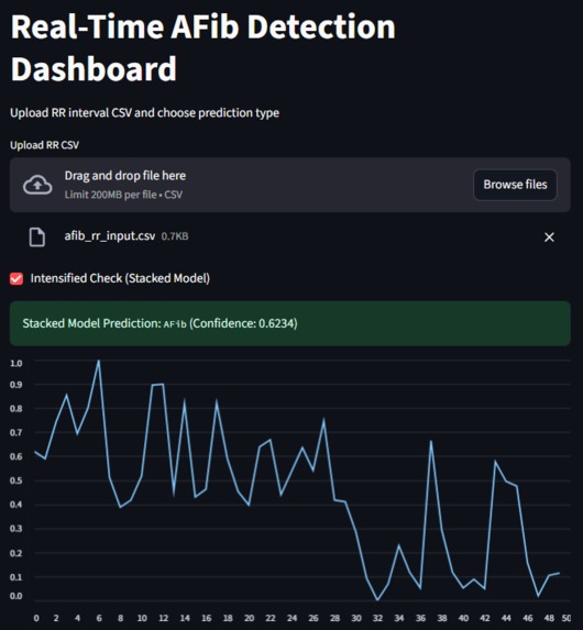NeuraRhythm: Real-Time AFib Detection Dashboard – screenshot 3
