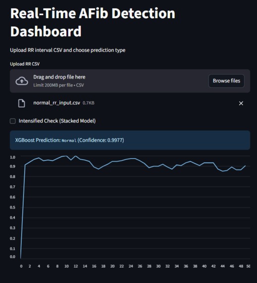 NeuraRhythm: Real-Time AFib Detection Dashboard – screenshot 4
