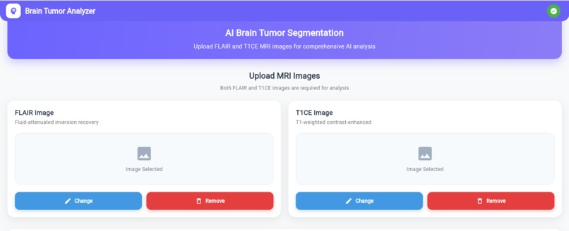 Brain Tumor AI Analyzer – screenshot 3