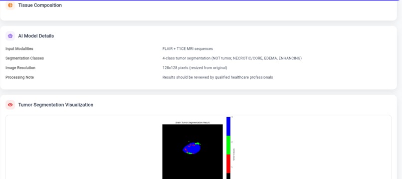 Brain Tumor AI Analyzer – screenshot 4