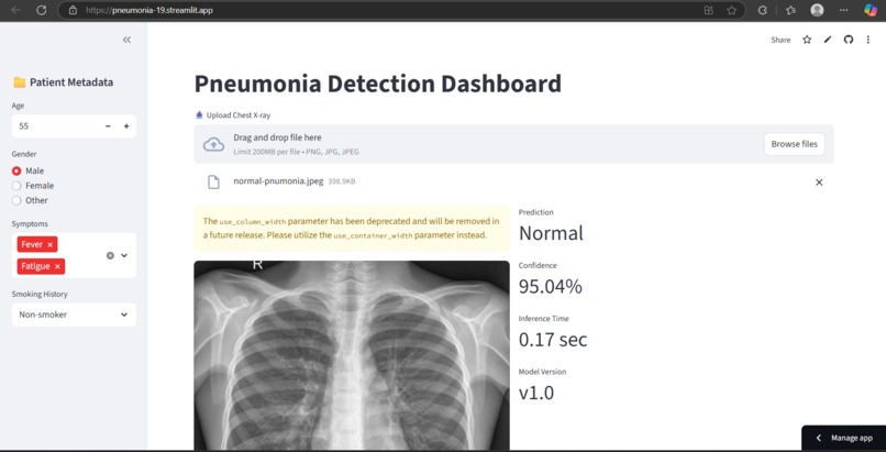  Pneumonia Disease Detection Using CNN + LSTM Hybrid Model – screenshot 1