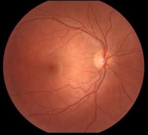 RetinAI – screenshot 2