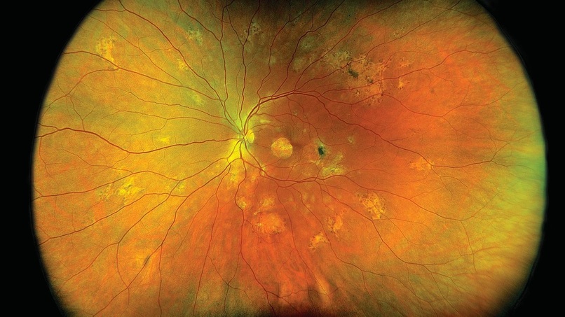 RetinAI – screenshot 8