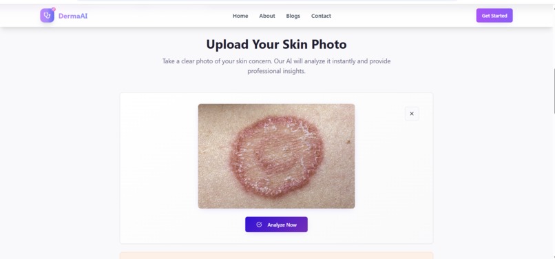Derma AI – screenshot 11