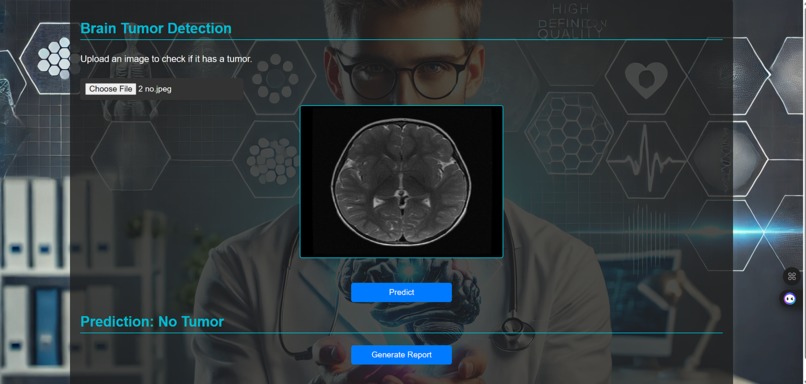 Automated Detection of Tumors in Brain MRI – screenshot 4