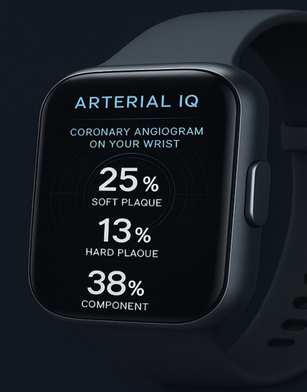 Arterial IQ  – screenshot 1