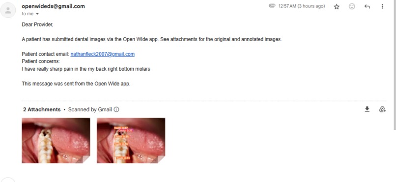 Open Wide Dental Scanner – screenshot 2