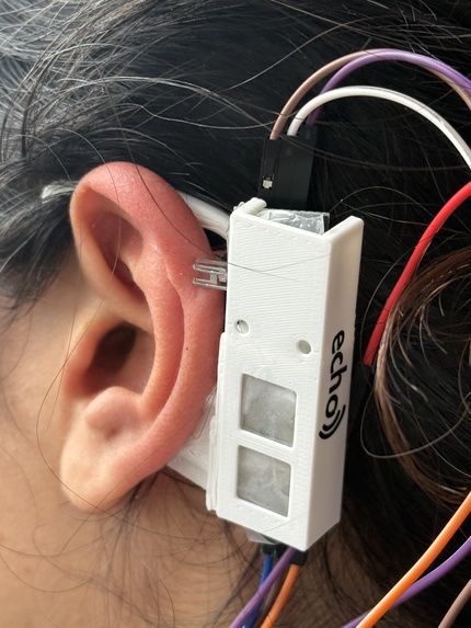 Echo – screenshot 2