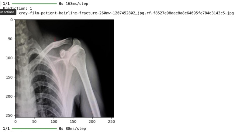 NanoScan: A Novel Tool For Detecting Hairline Fractures  – screenshot 1