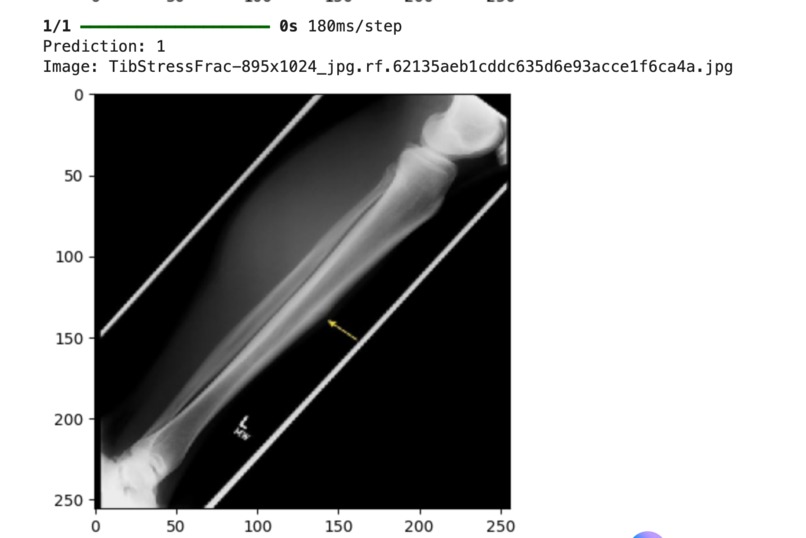 NanoScan: A Novel Tool For Detecting Hairline Fractures  – screenshot 2