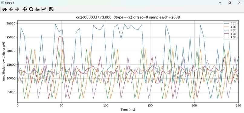 EEG Analysis Solution for Neuroscientists – screenshot 3