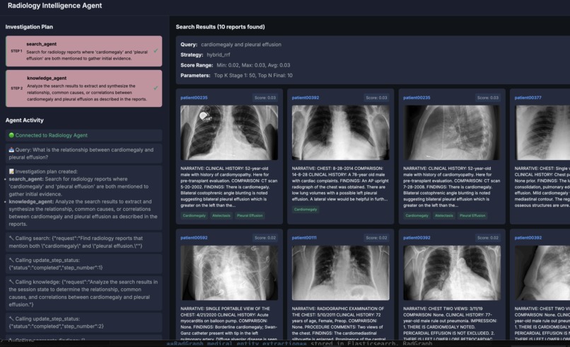 Levia: Multi-Agent Radiology Intelligence System – screenshot 1